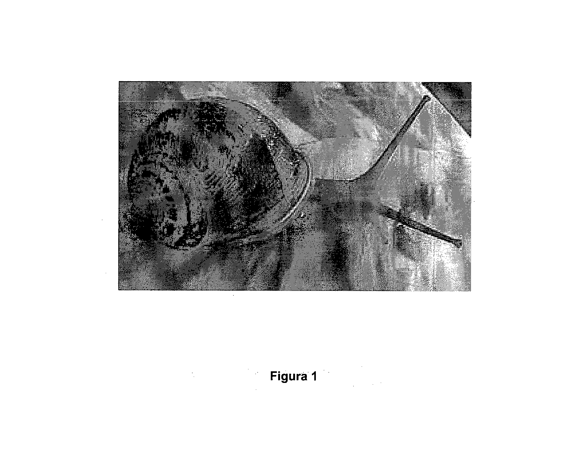 Pharmaceutical composition and device for preventing, treating and curing ulcers on a diabetic foot and other wounds, which includes snail slime from the species cryptophalus aspersus or helix aspersa muller and pharmaceutically acceptable carriers and/or additives