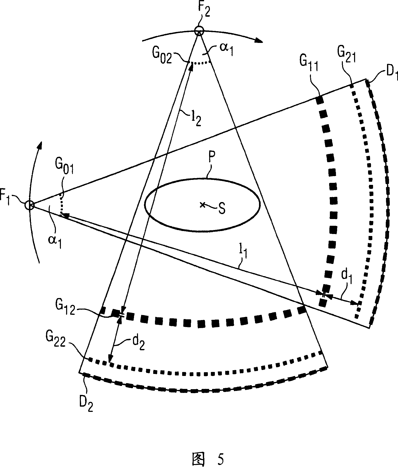 Method and CT system for detecting and differentiating plaque in vessel structures of a patient