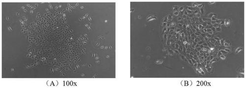 Establishment and application method of immortalized Hu sheep rumen epithelial cell line