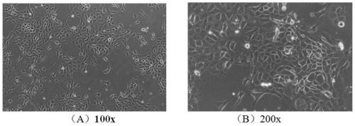 Establishment and application method of immortalized Hu sheep rumen epithelial cell line