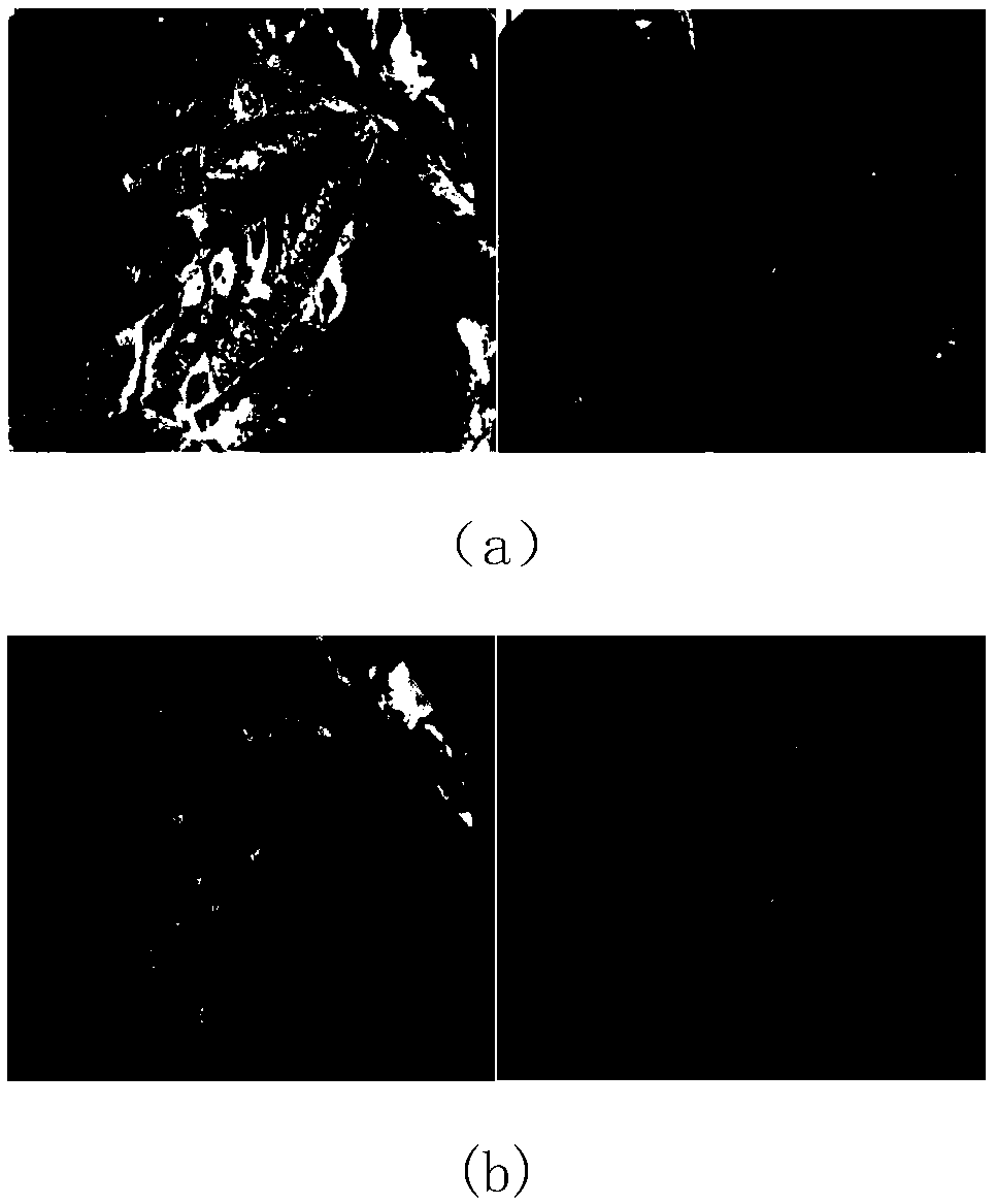 A method for identifying fruit tree diseases and pests under complex background based on cavity convolution