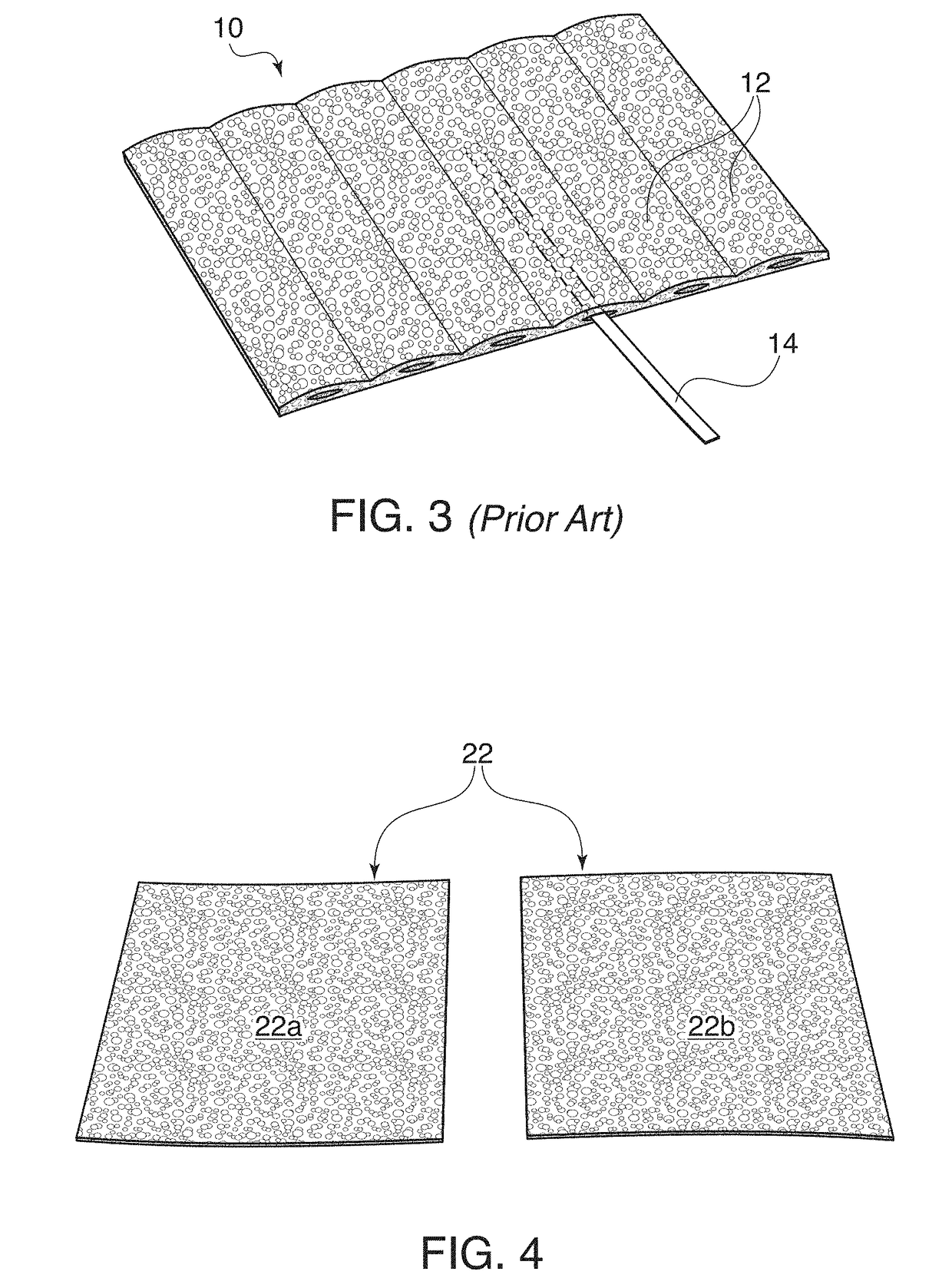 Channel Implant