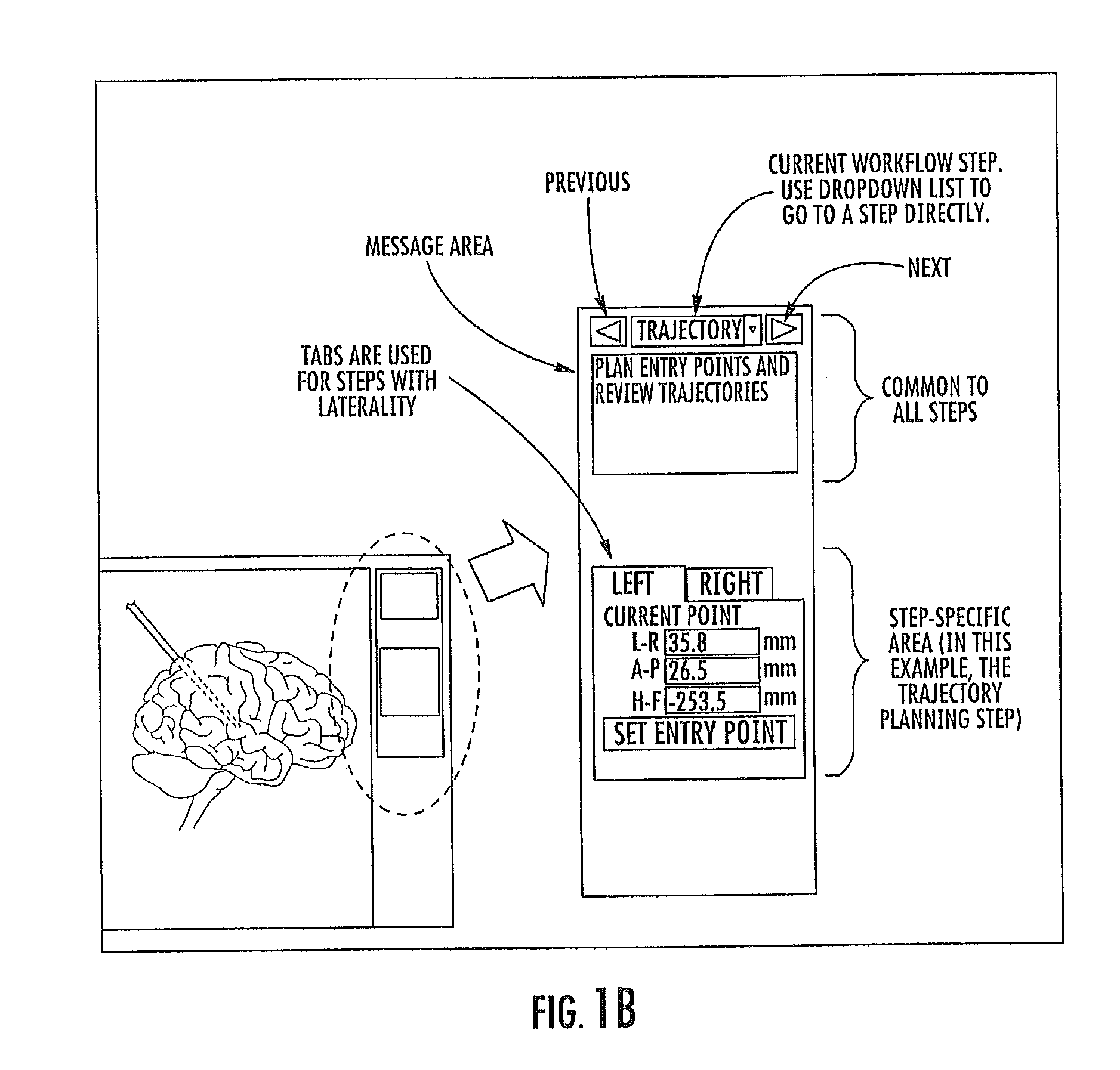 MRI-Guided Medical Interventional Systems and Methods