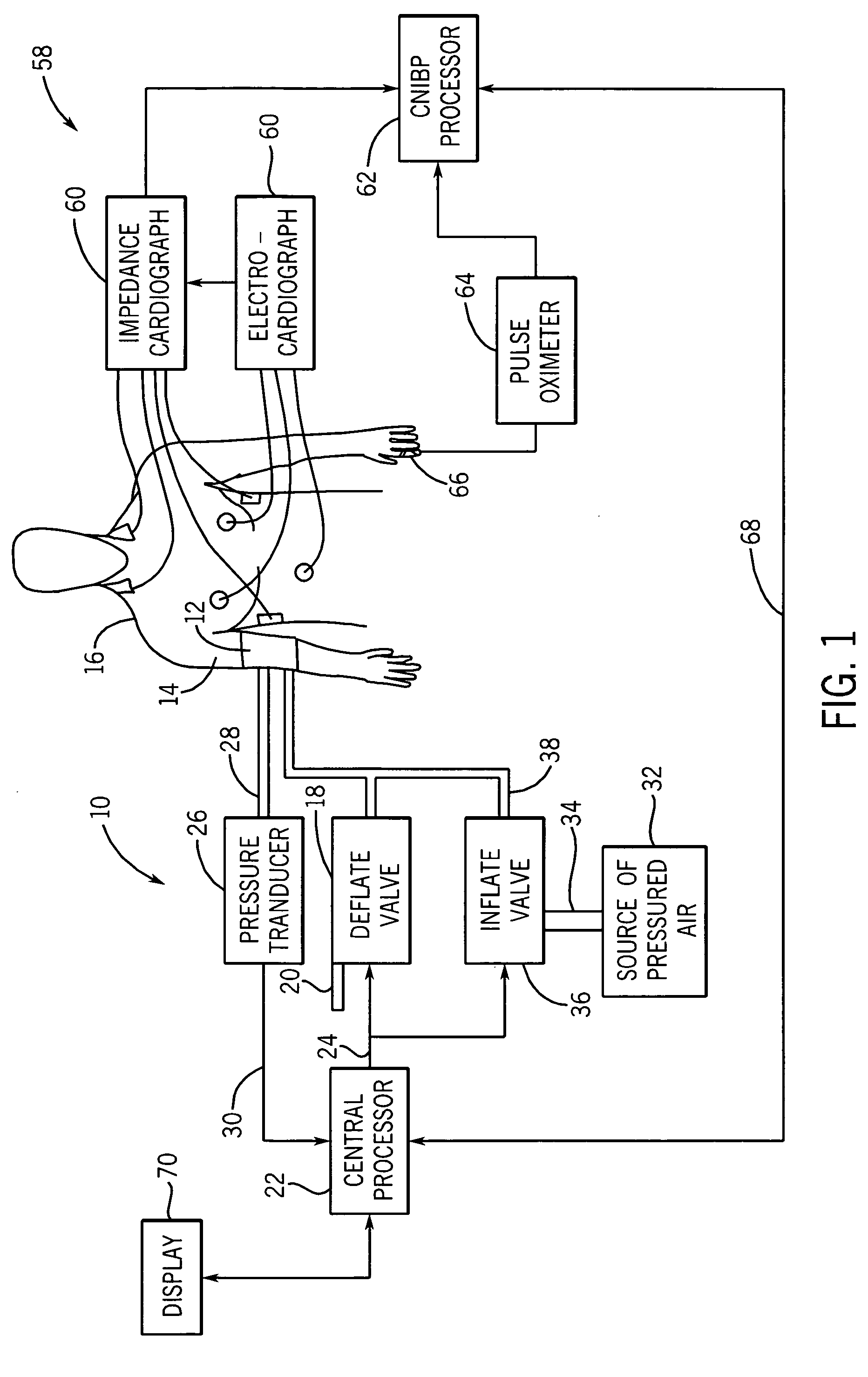 Non-invasive blood pressure monitor with improved performance