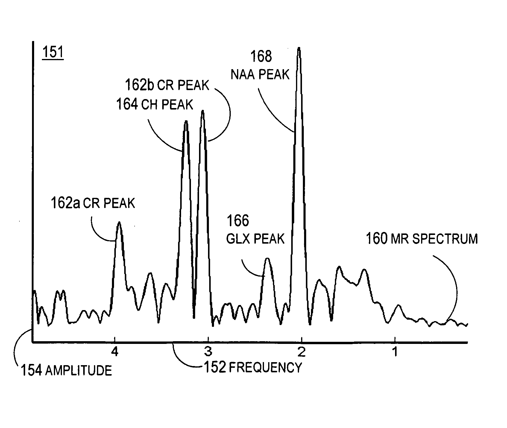 Spectral resolution enhancement of magnetic resonance spectroscopic imaging