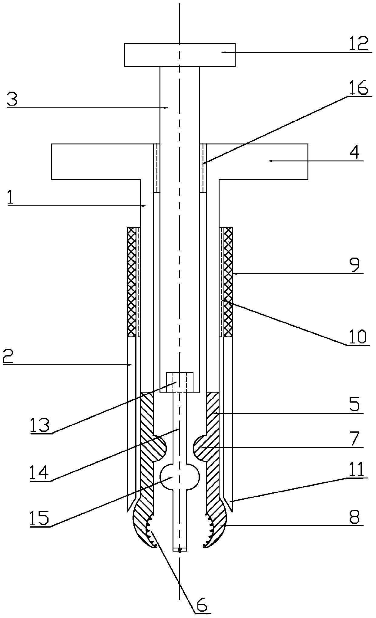 Nail remover for orthopedic surgery