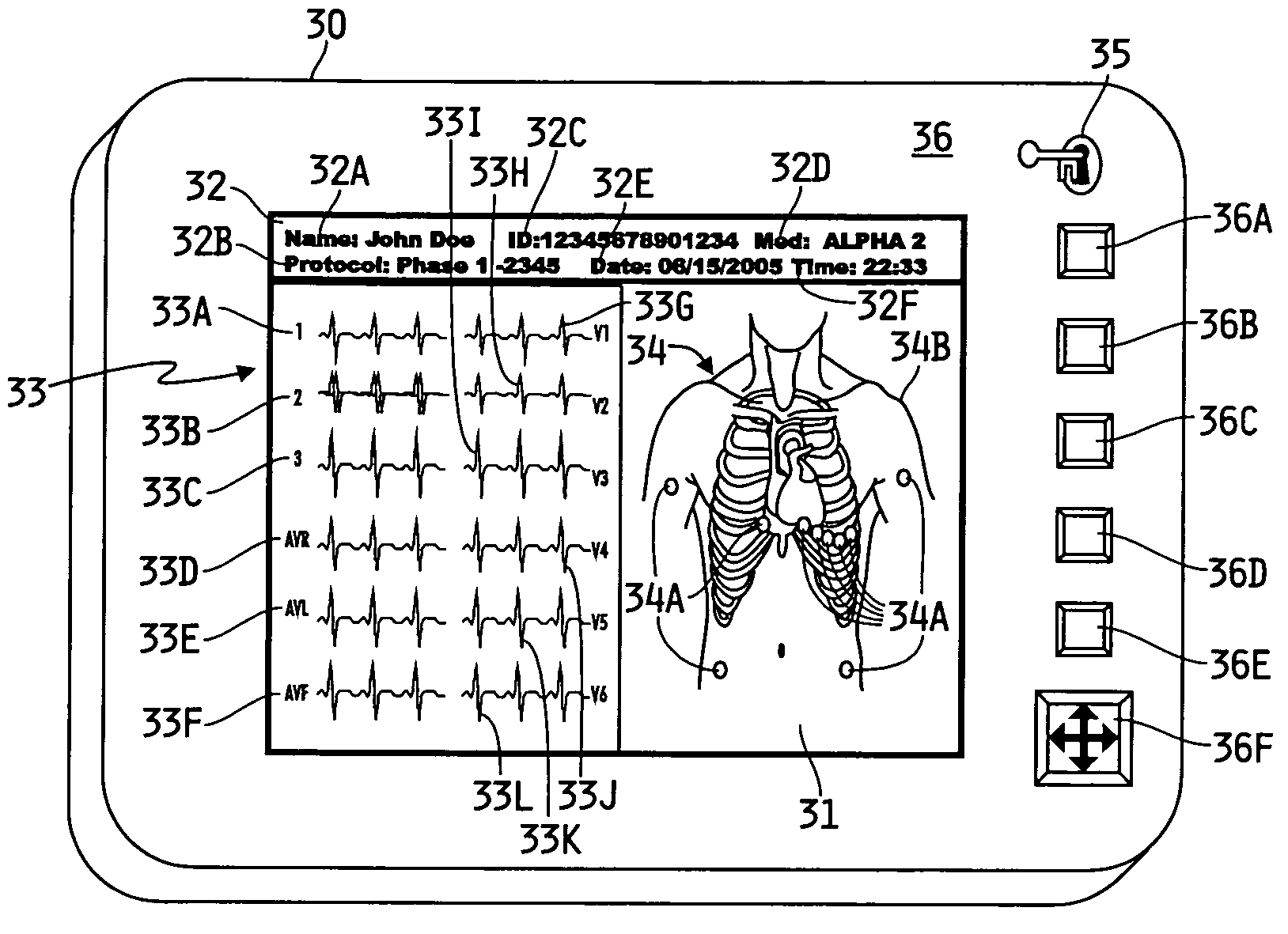 Method and system for collecting data on a plurality of patients