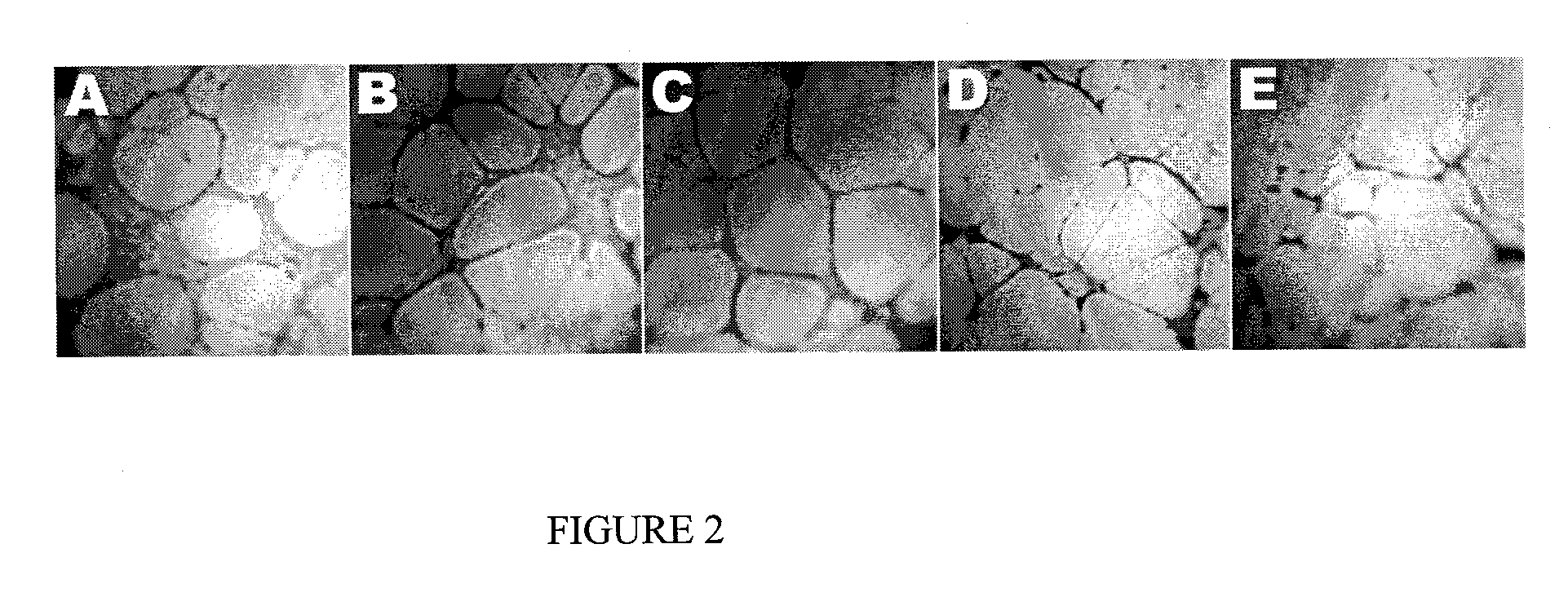 Methods and products for treatment of diseases