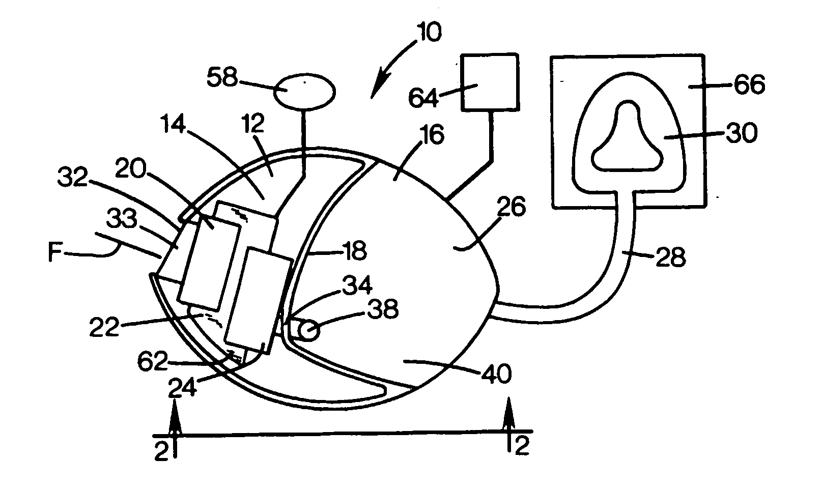 Breathing device