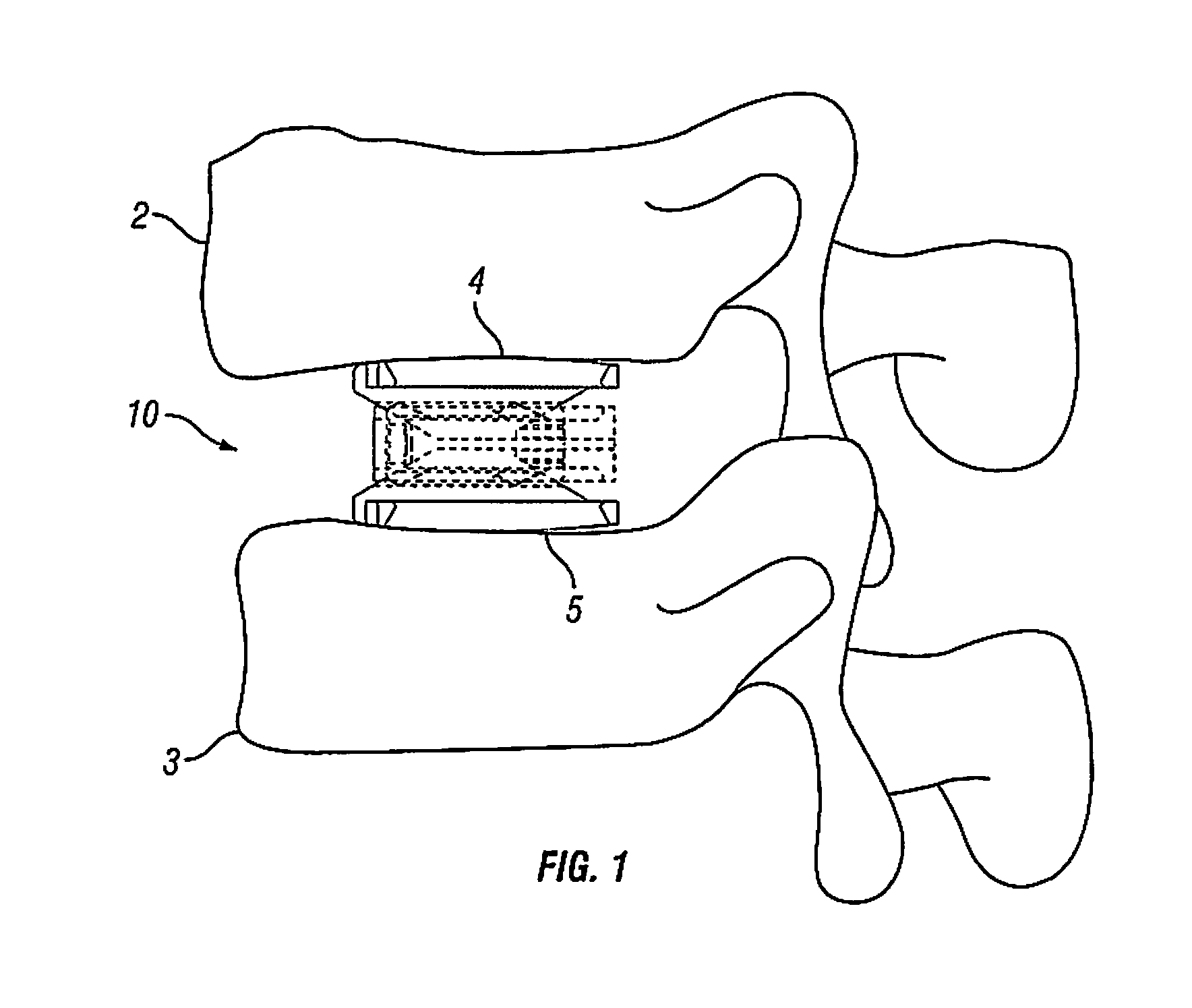 Expandable fusion device and method of installation thereof