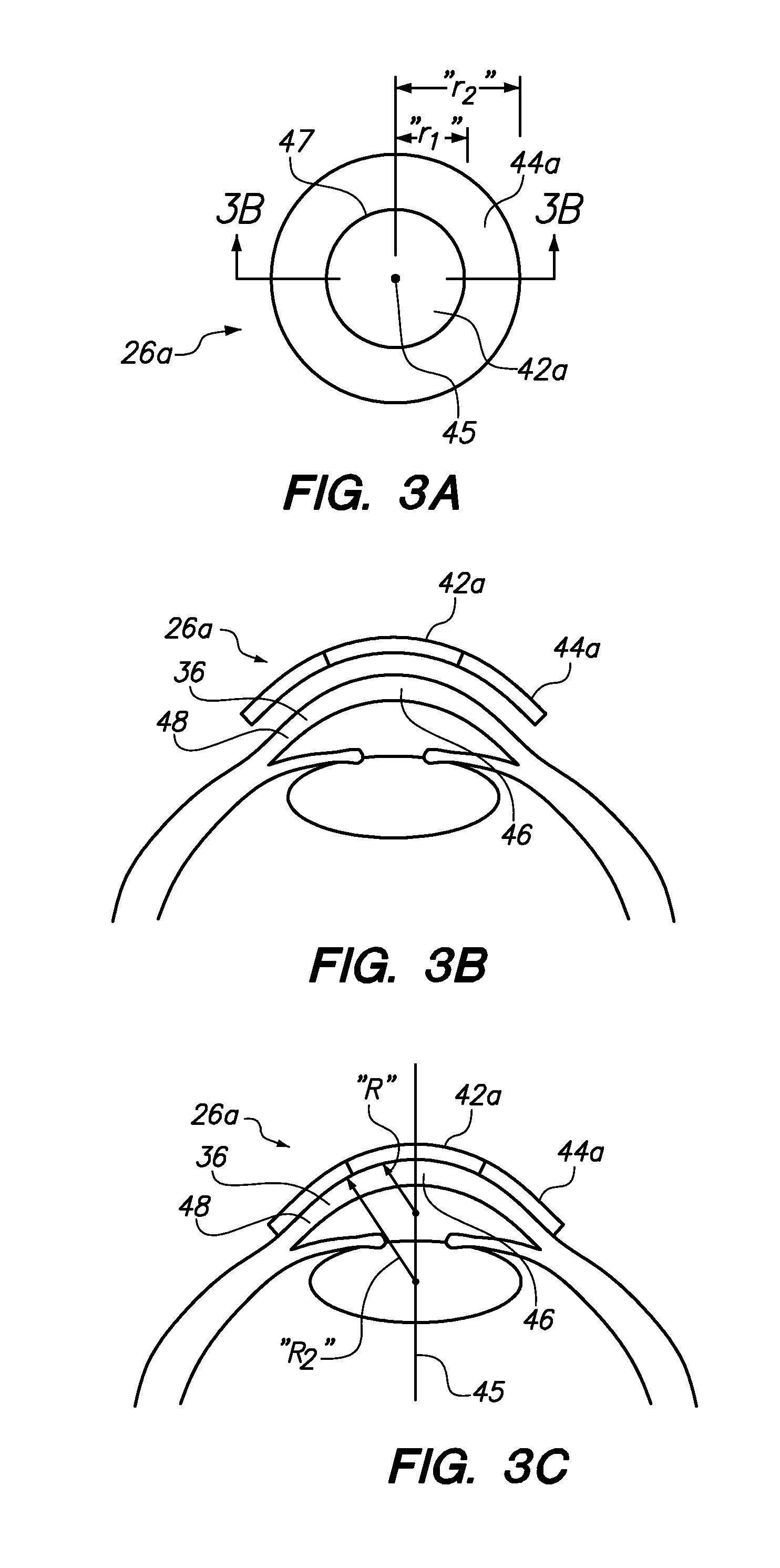 Adaptable patient interface