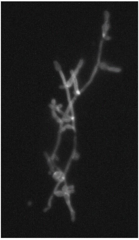 Fungus detection fluorescent dyeing liquid and use thereof