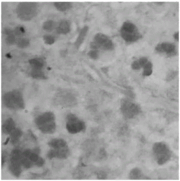 Fungus detection fluorescent dyeing liquid and use thereof