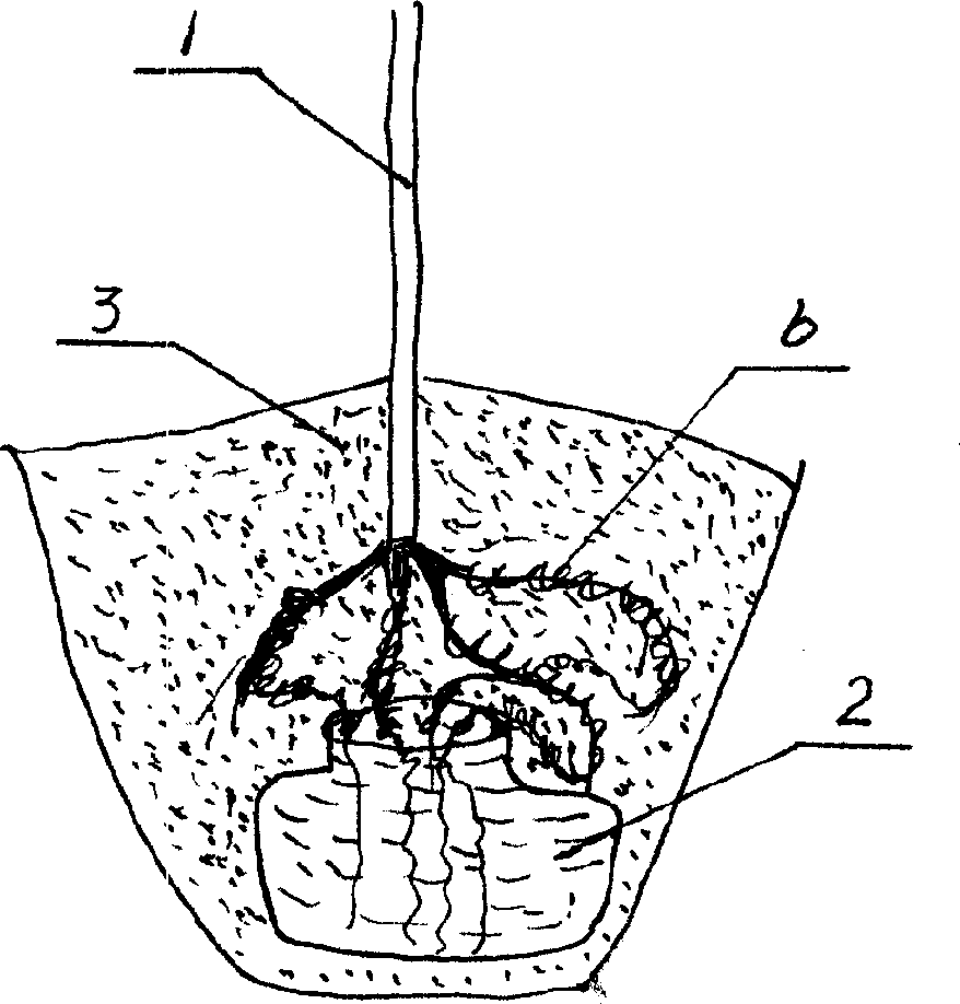 Method for increasing tree-planting survival rate in dryland