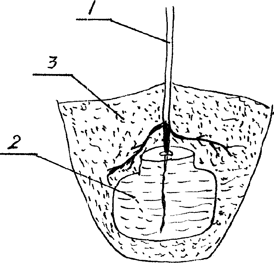 Method for increasing tree-planting survival rate in dryland