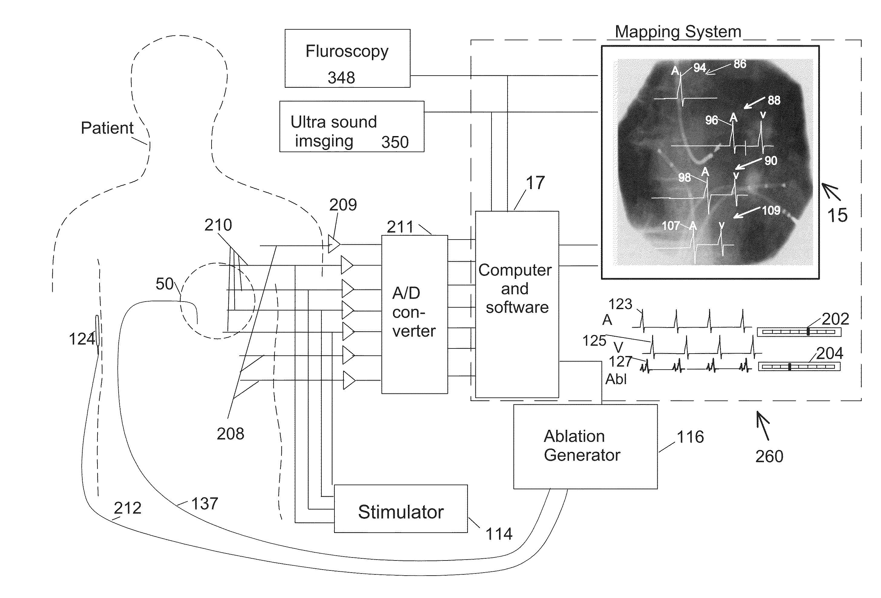 Methods and system for real-time cardiac mapping