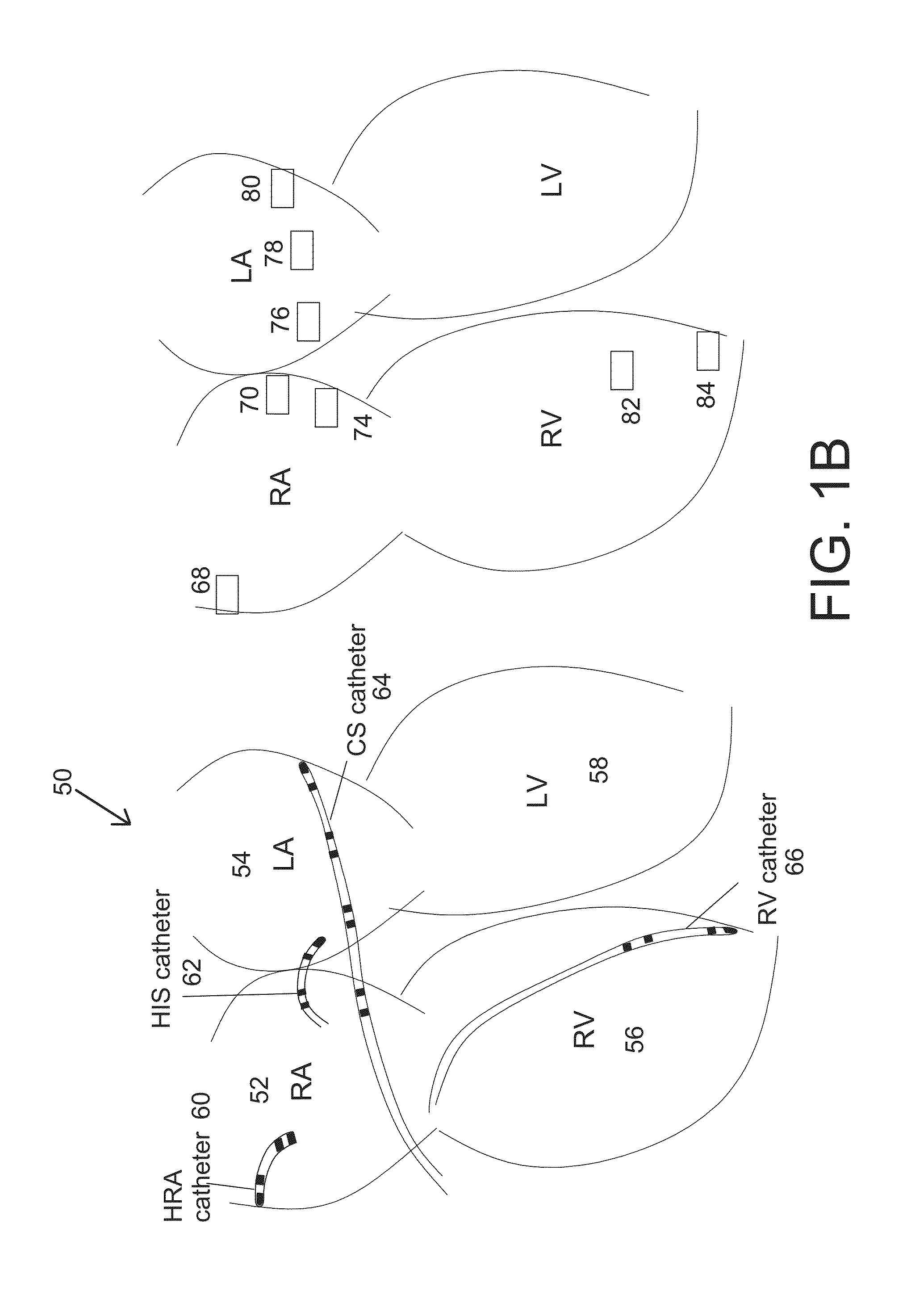 Methods and system for real-time cardiac mapping