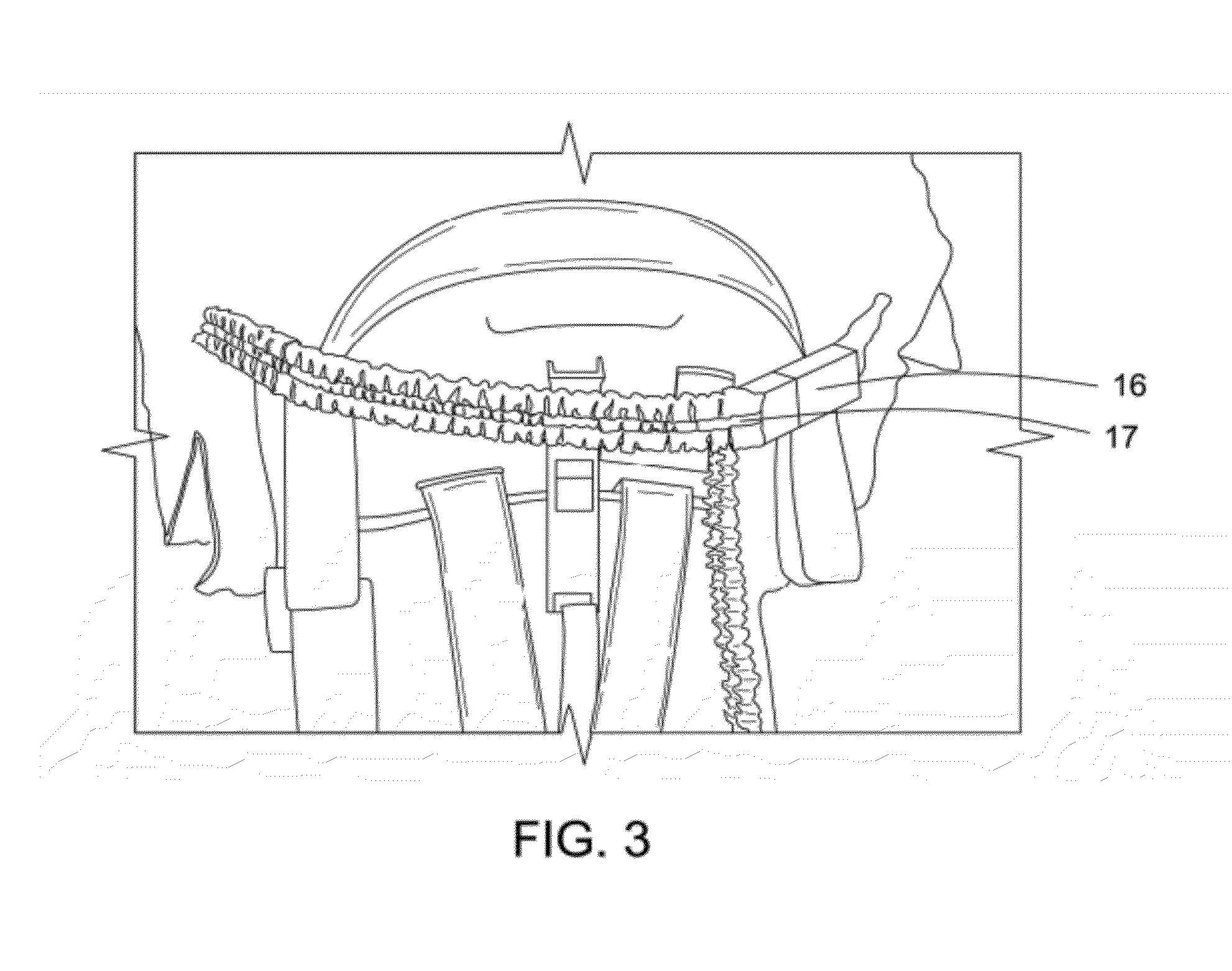 Method of protecting an infant or toddler from both sun's rays and from overheating in warm weather