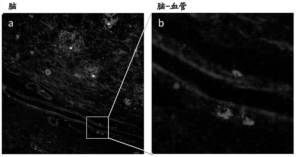 Method for analyzing blood to detect diseases associated with abnormal protein aggregation