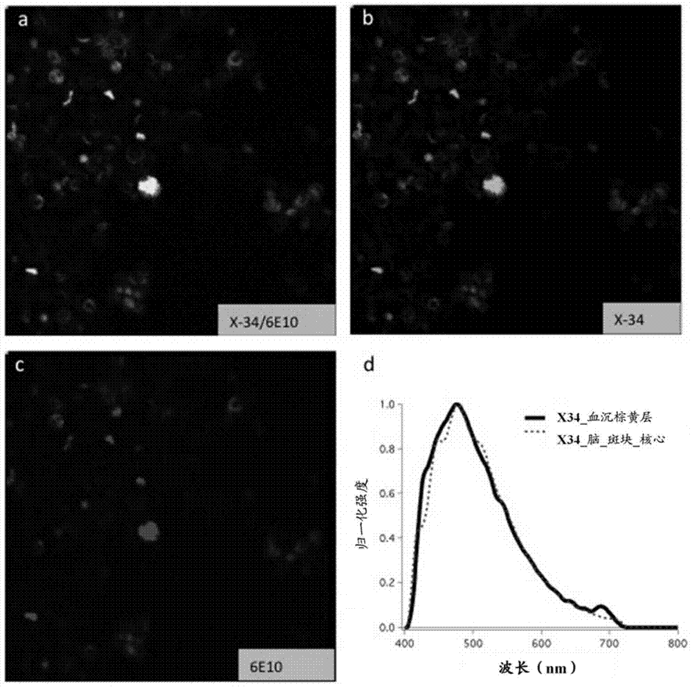 Method for analyzing blood to detect diseases associated with abnormal protein aggregation