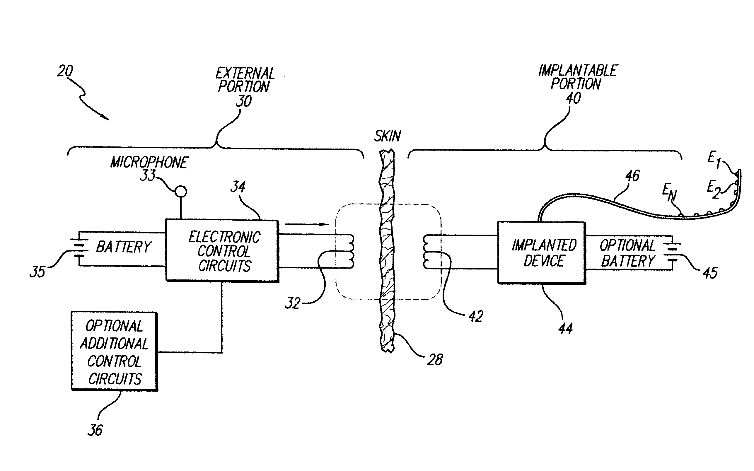 Cochlear Stimulation Device