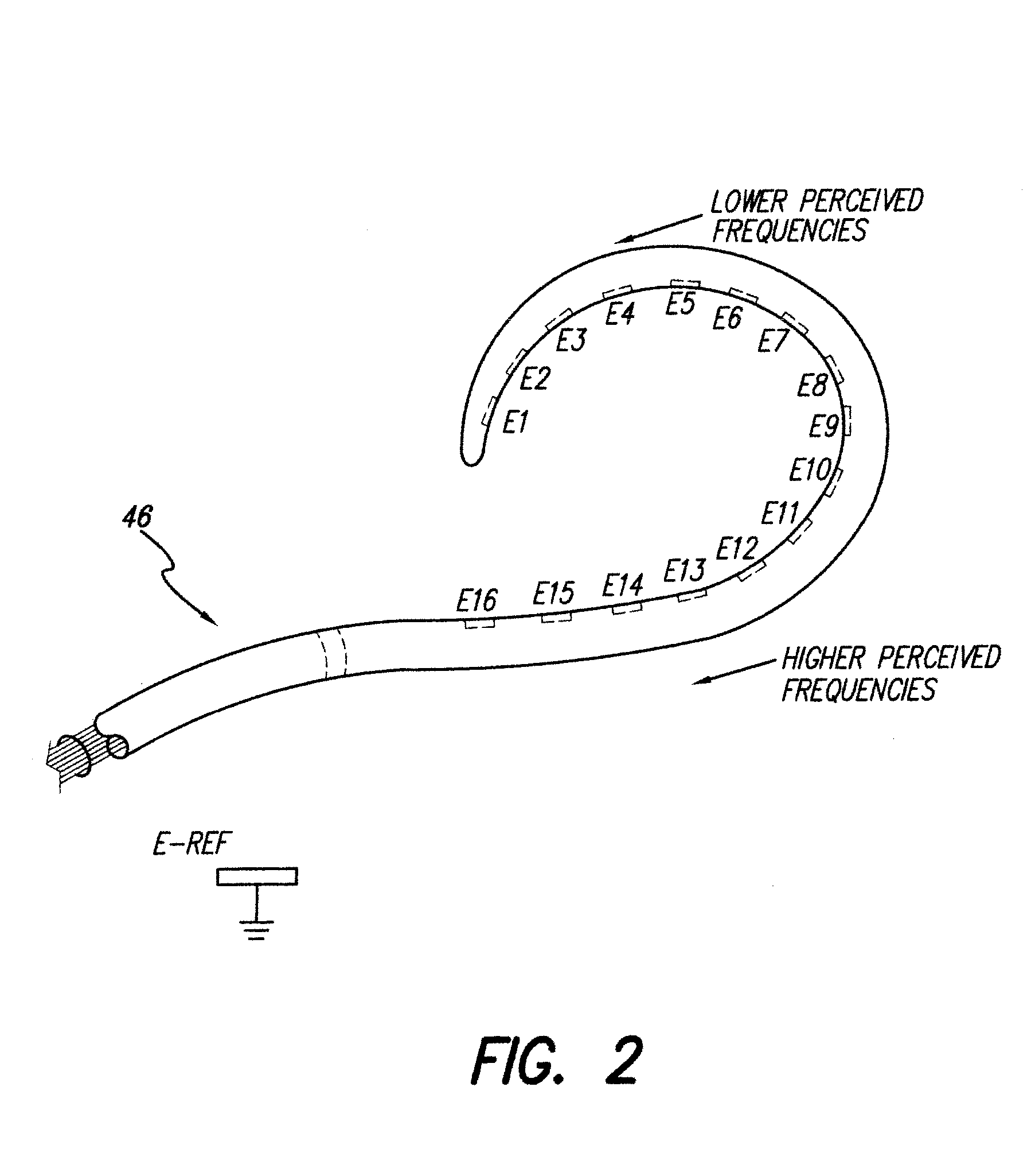 Cochlear Stimulation Device