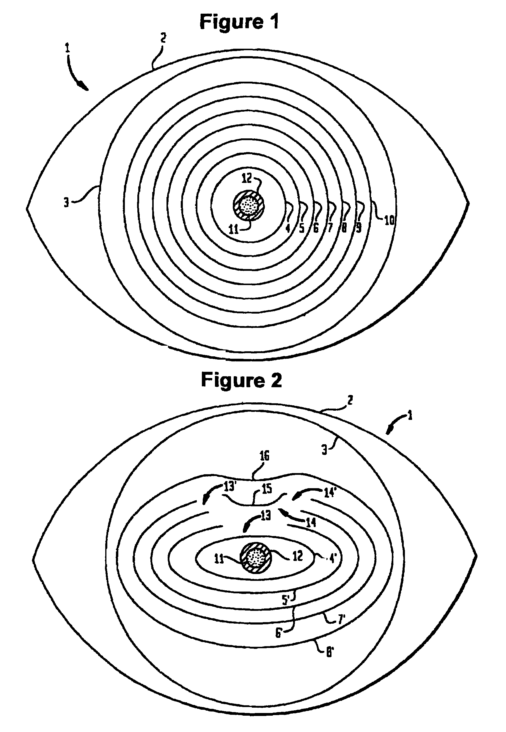 Selective corneal aberrometry