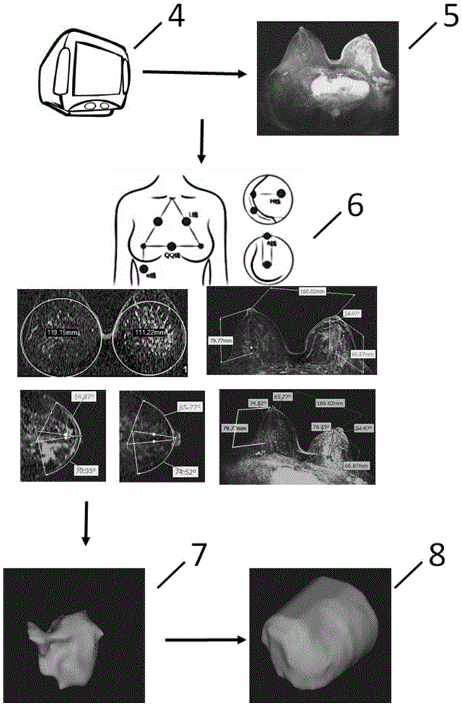 A method for manufacturing breast prosthesis based on three-dimensional printing technology