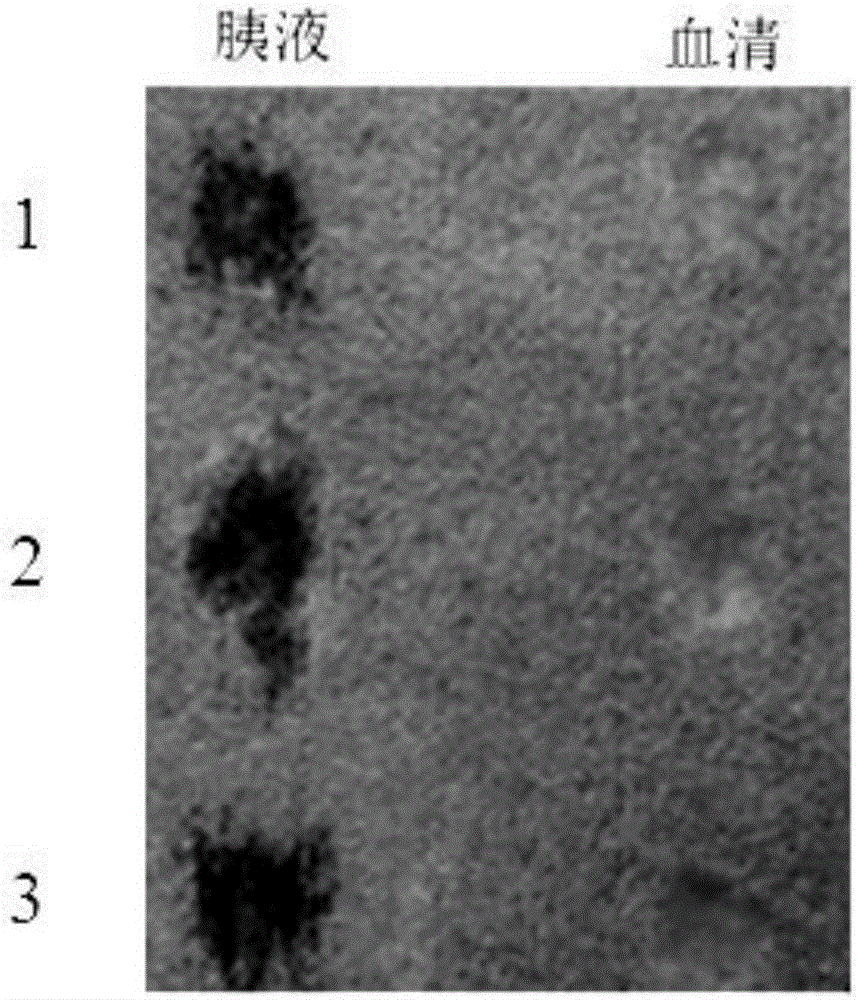 Pancreatic leakage detection material based on acid-base indication compound chemical color changes and application thereof