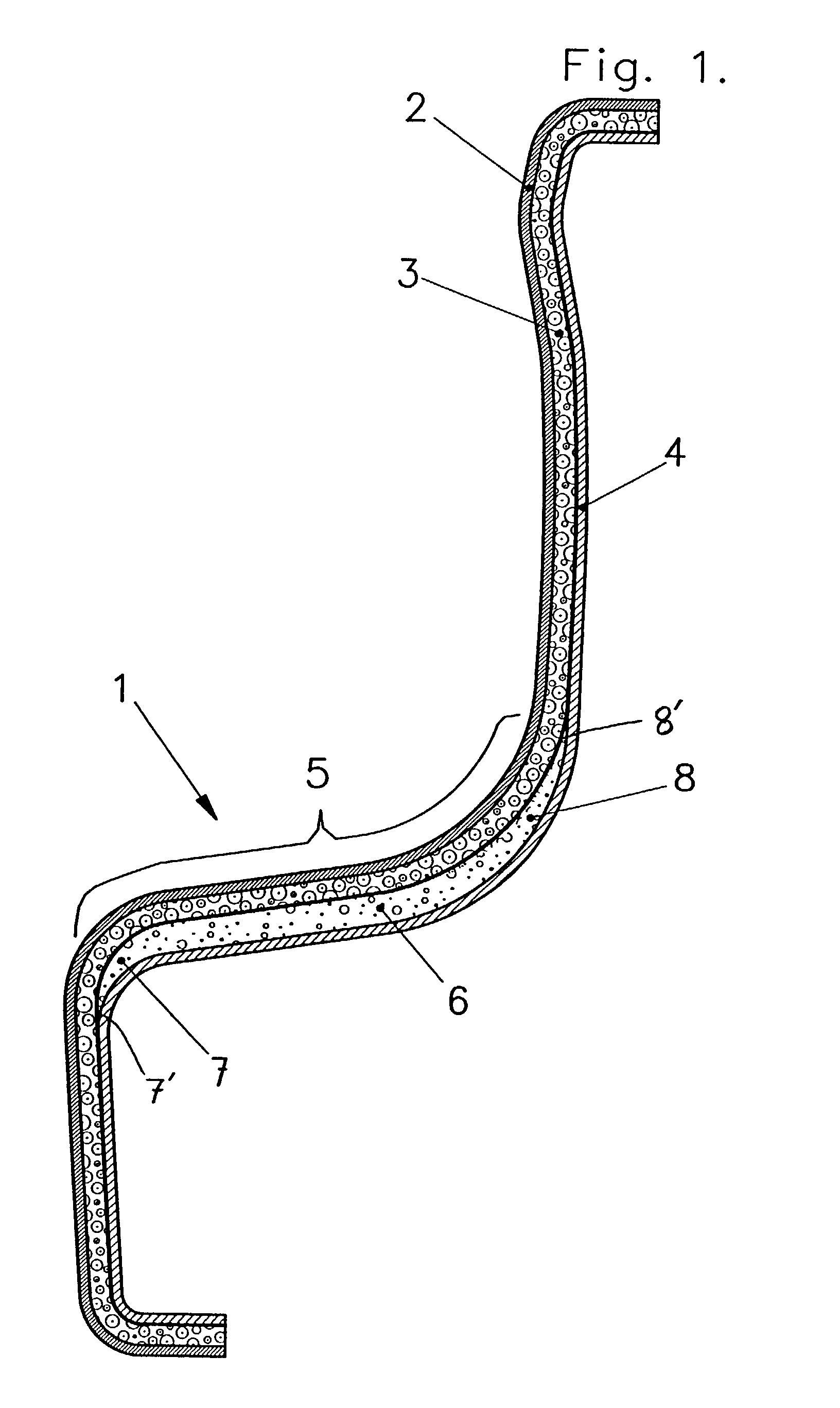 Method and apparatus for making a trim component with a foam core having a smoothly varying thickness