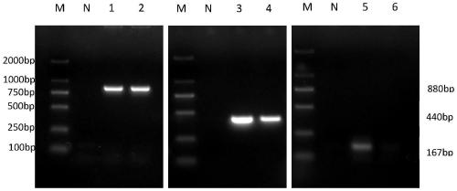 Primer set for simultaneously detecting three kinds of microsporidia and application of primer set