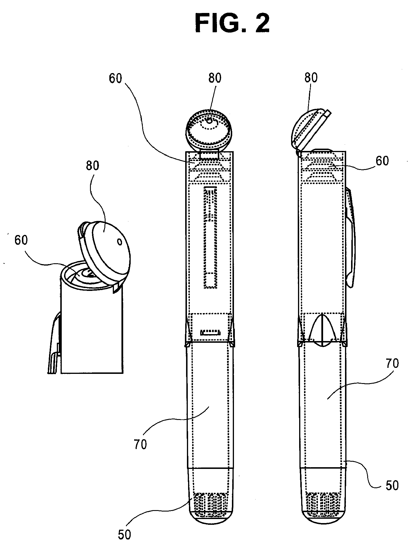 Epinephrine dosing regimens comprising buccal, lingual or sublingual and injectable dosage forms