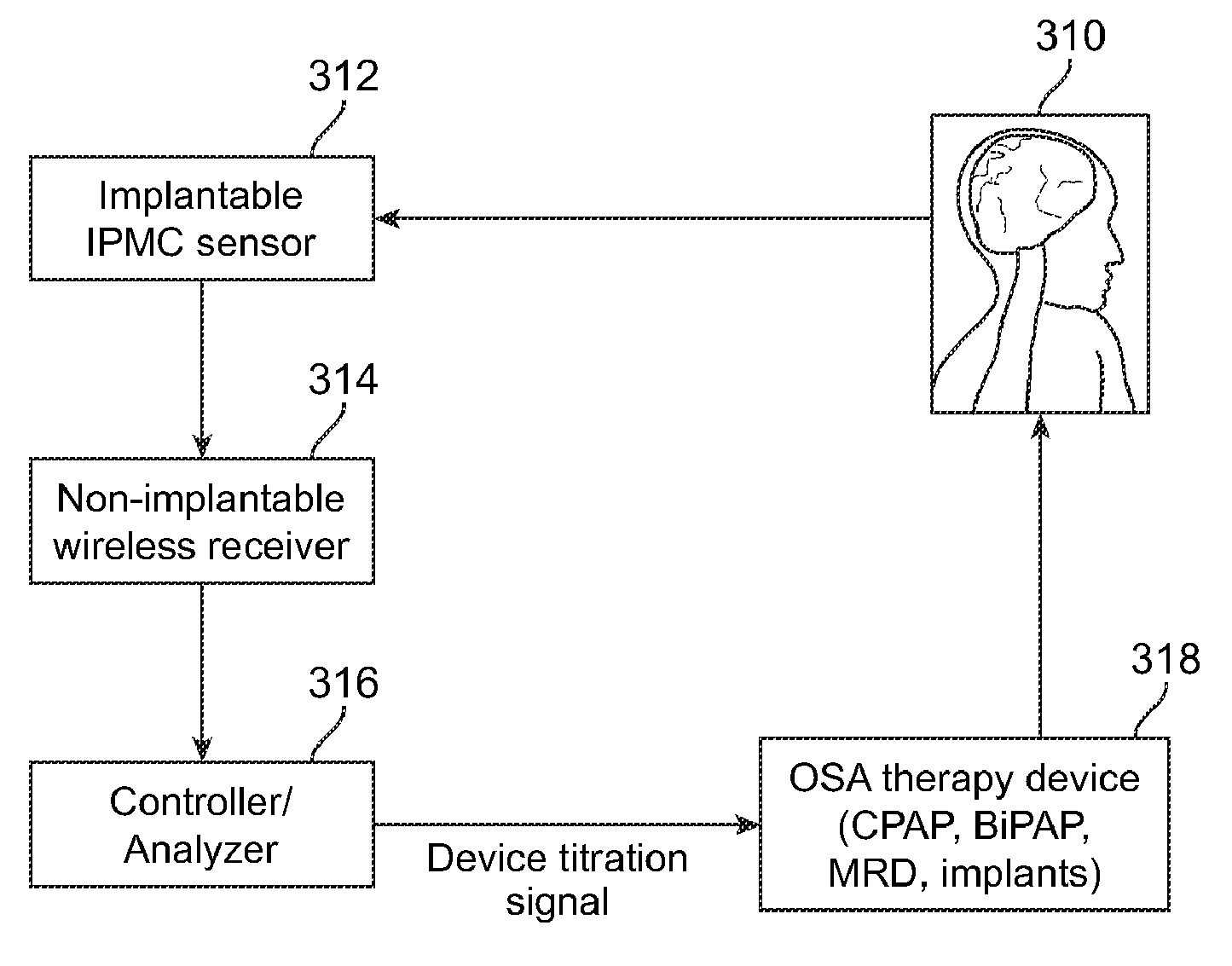 Auto-Titration of Positive Airway Pressure Machine With Feedback From Implantable Sensor