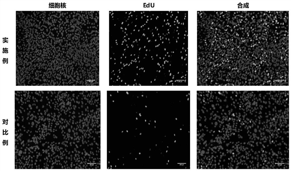 A kind of rpe cell sheet and its application and preparation method