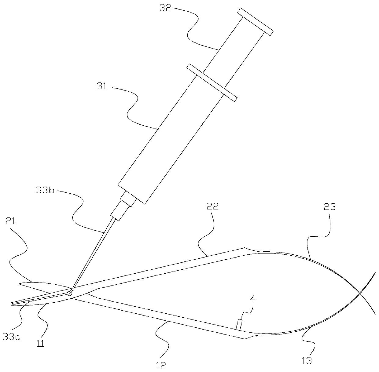 Separating scissors for deep lamellar keratoplasty