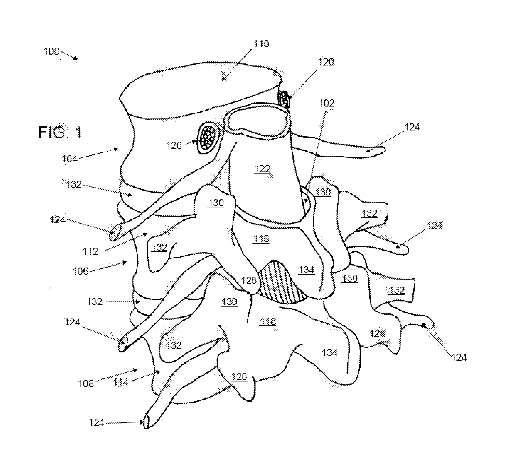 Discectomy devices and related methods