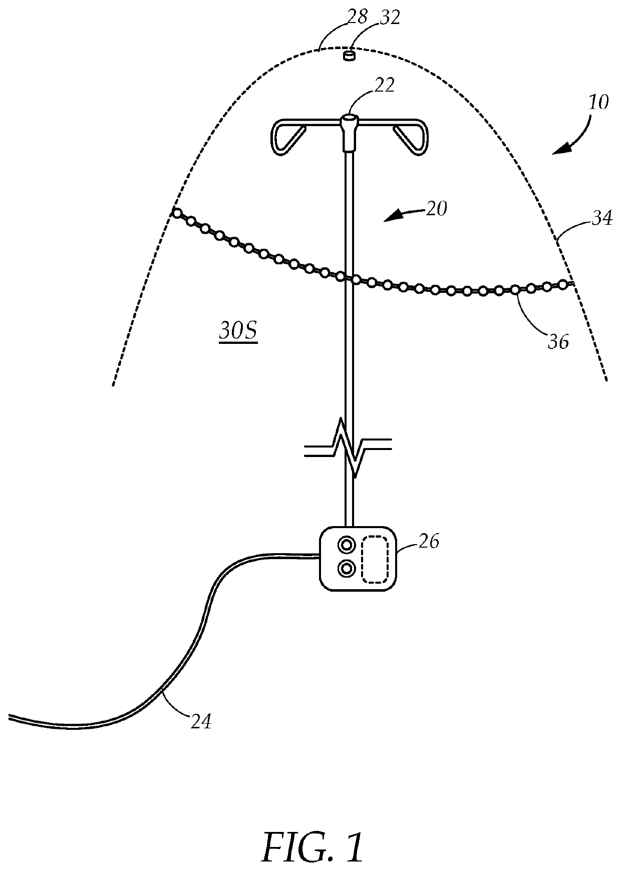 Self-sterilizing iv pole system