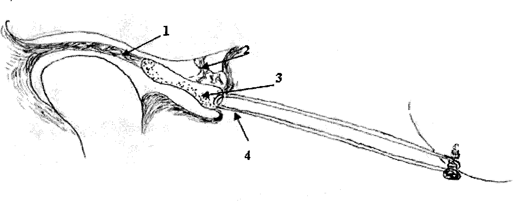 Animal model for showing rabbit temporomandibular joint intracapsular synechia and building method thereof