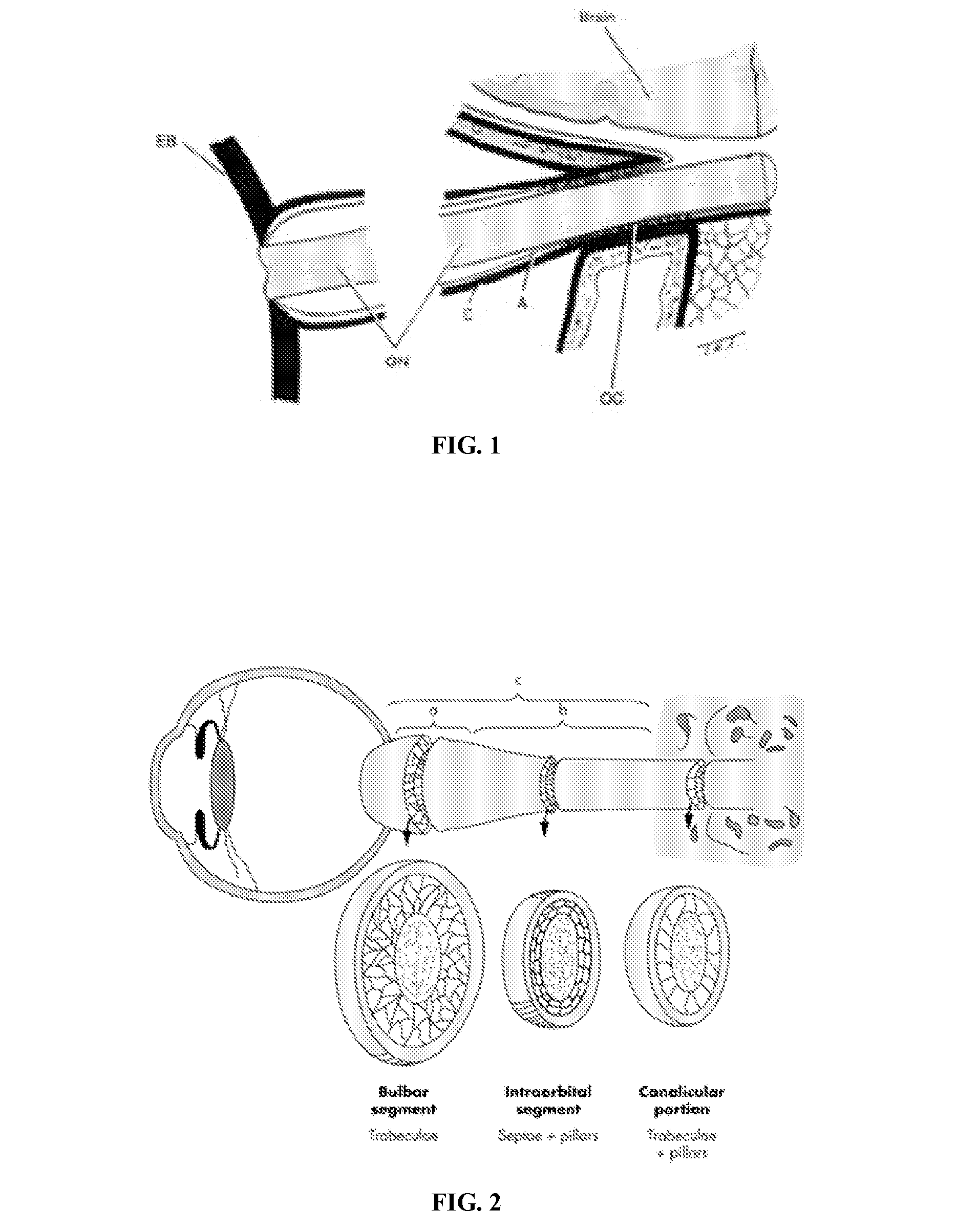 Systems and methods for detecting intracranial pressure and volume