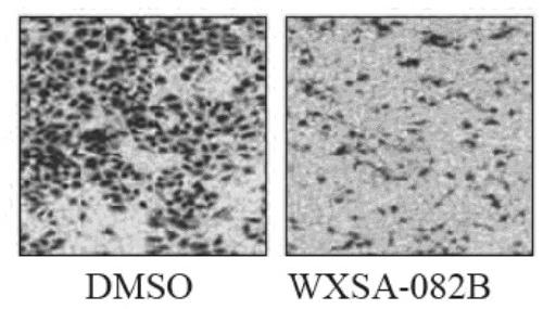 Compound based on inhibiting histone demethylase as well as preparation method thereof and application in resisting gastric carcinoma