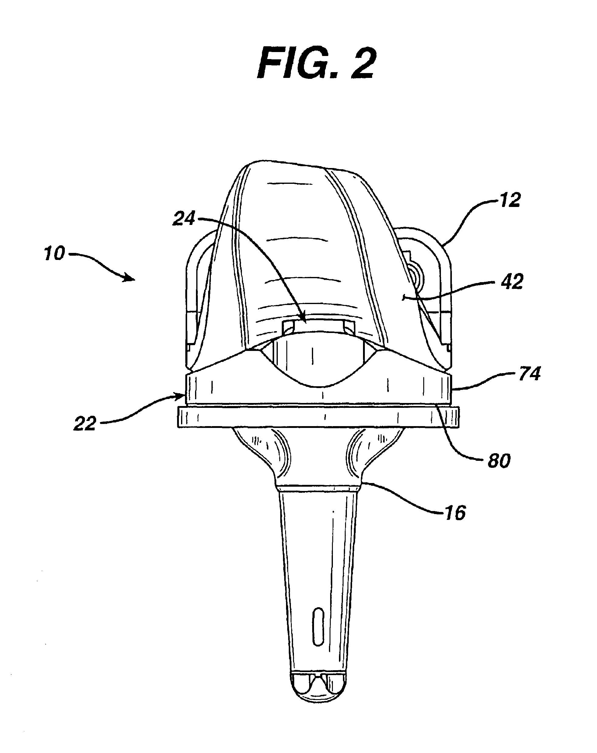 Joint replacement prosthesis component with non linear insert