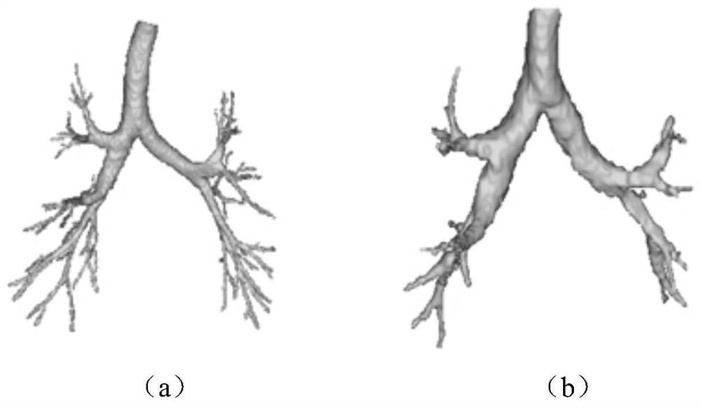 A predictive method for chronic obstructive pulmonary disease based on reconstructed airway tree images