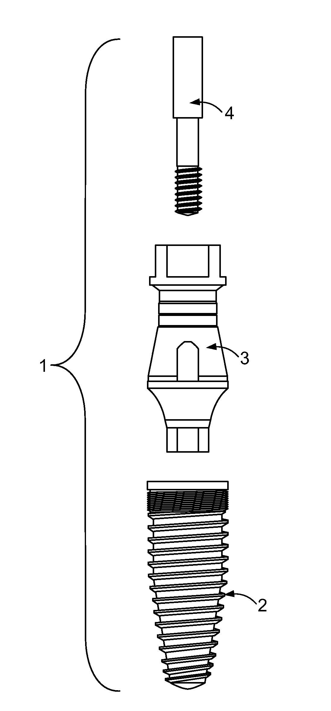 Dental implant system