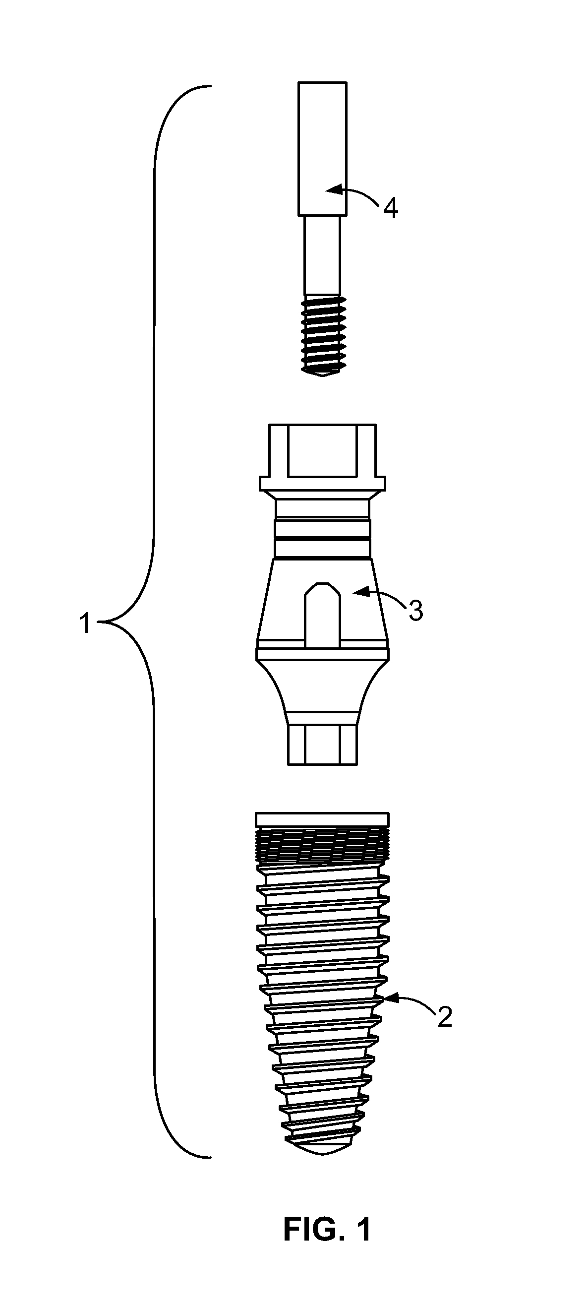 Dental implant system