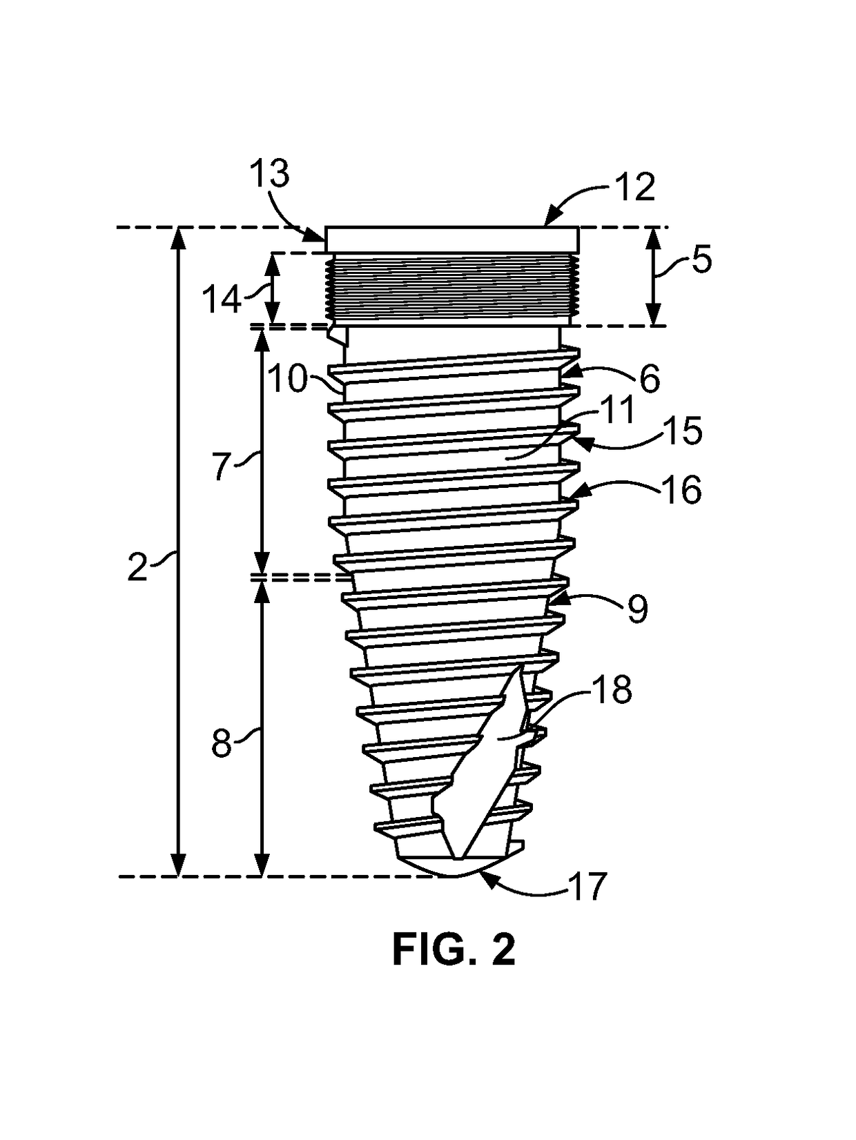 Dental implant system