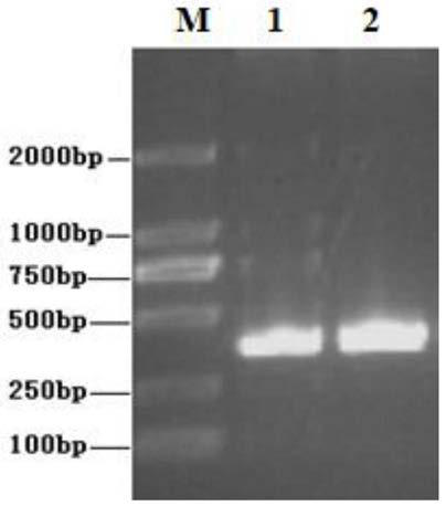 Bovine testis sertoli cell carcinoma cell, and application thereof in separation and culture of poxviruses