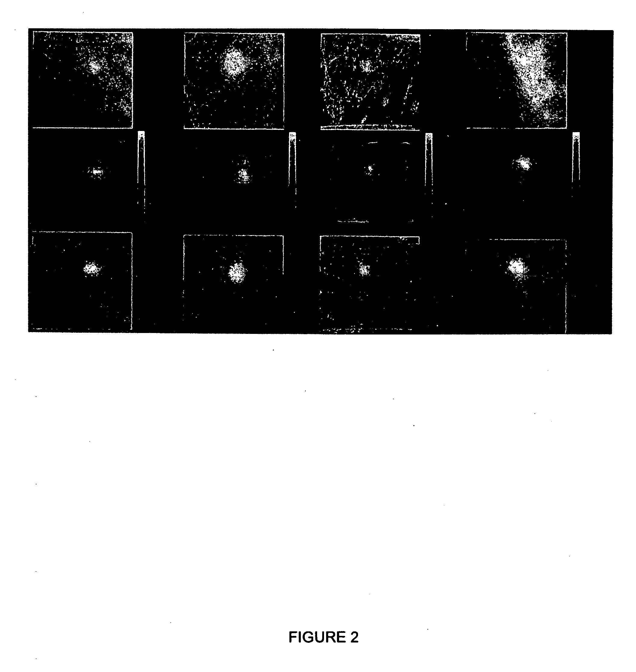 Opposed view and dual head detector apparatus for diagnosis and biopsy with image processing methods