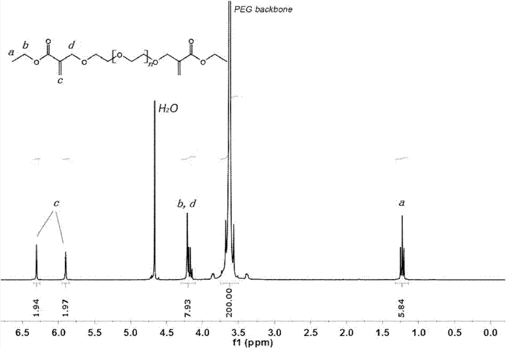 In-situ crosslinked hydrogel for intraocular tamponade, and preparation method and application thereof