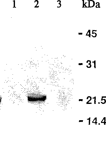 Insoluble biological activity protein as vitreous body oral medicine for treating ophthalmic diseases