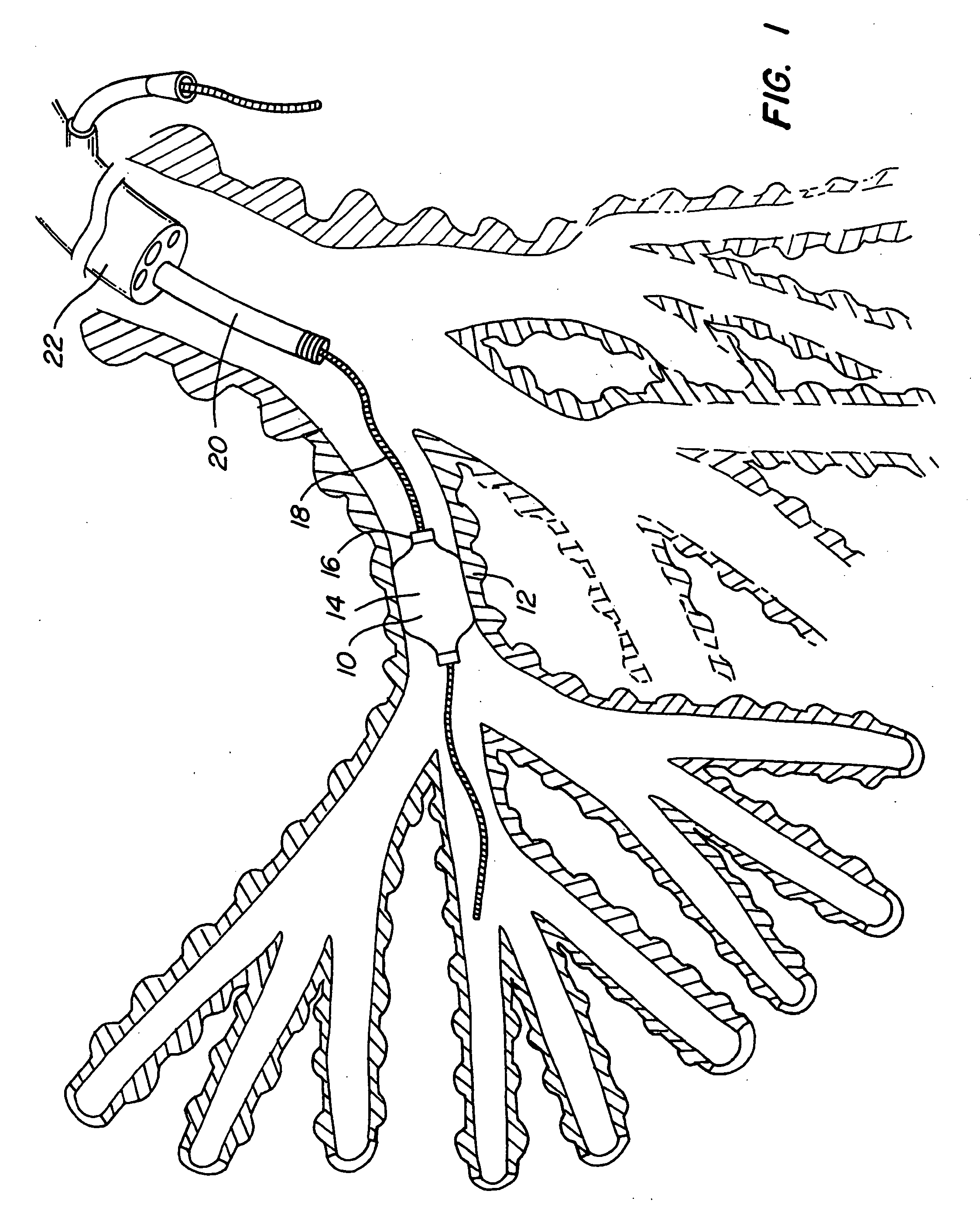 Method of compressing a portion of a lung